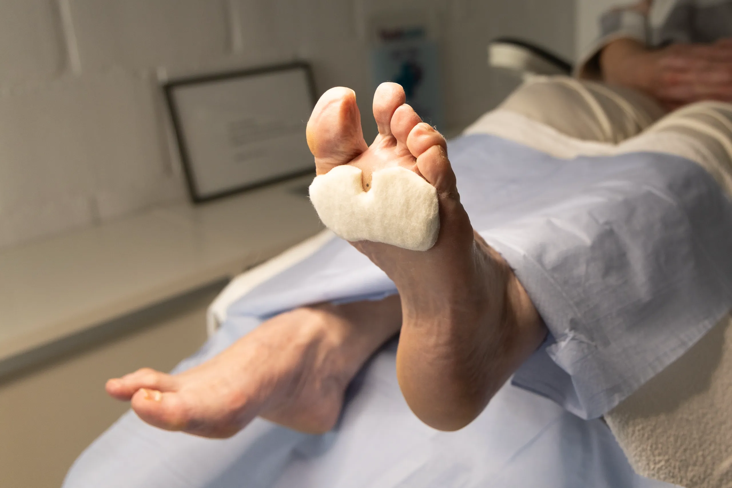 Wondzorg en vilttherapie